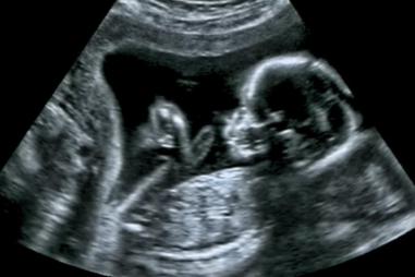 baby_in_the_womb-810x500.jpg