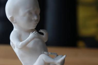 3D_printed_ultrasound.jpg