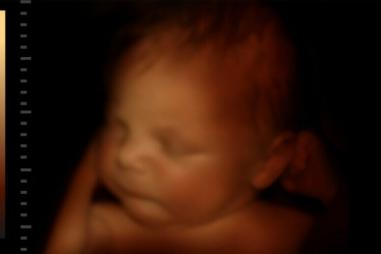 Unborn-baby-late-term-e1711109370821-810x500.jpeg