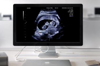 ultrasound-810x500.jpg