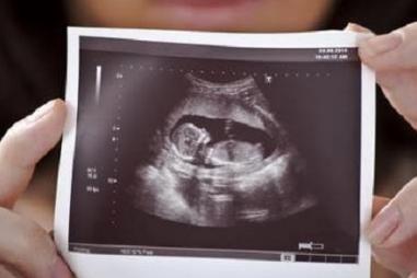 ultrasound3d20.jpg