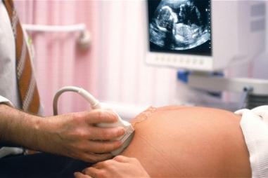 ultrasound3d53.jpg