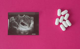 Abortion-pills-1-e1711121677572-810x500.jpg