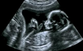 baby_in_the_womb-810x500.jpg