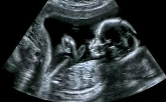 ultrasound-810x500.jpg