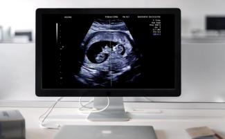 ultrasound-810x500.jpg